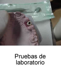 Pruebas de laboratorio