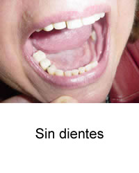 Sin dientes