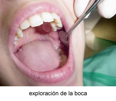 las muelas del juicio: exploración de la boca