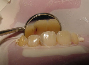 qu&eacute; es una ondodoncia 01