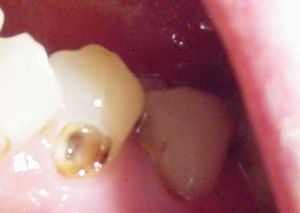 qu&eacute; es una ondodoncia 02