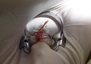 qu&eacute; es una ondodoncia 07